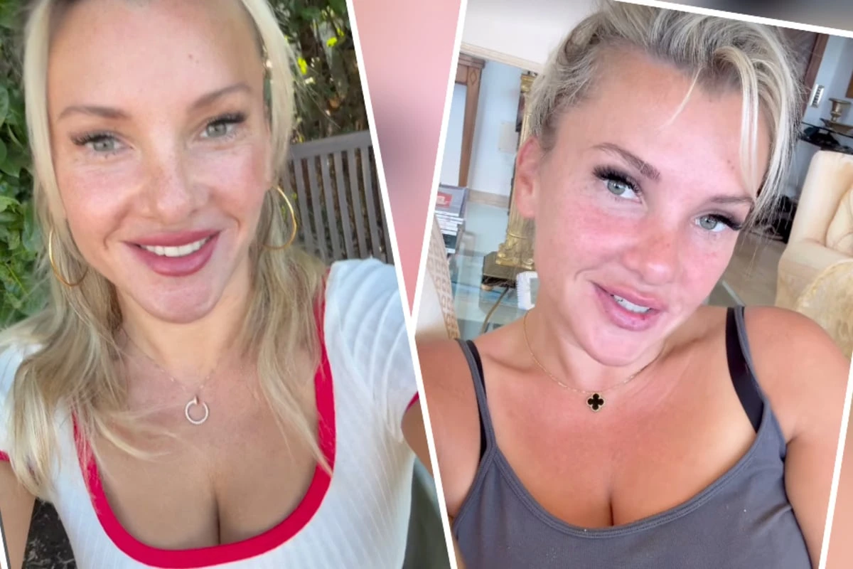 Evelyn Burdecki offenbart Schönheitsfehler: Darunter hat sie jahrelang gelitten