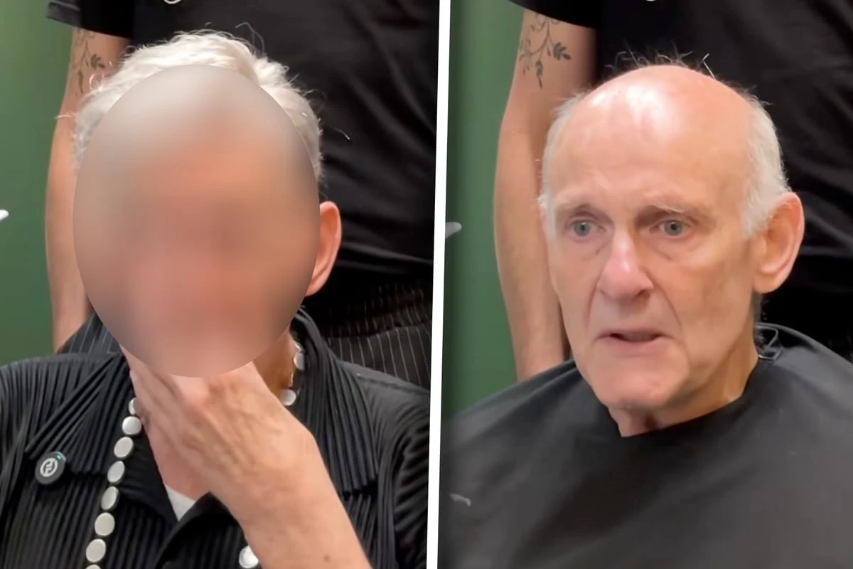 Mann leidet sehr unter Glatze: Was Haar-Experte aus ihm macht, raubt ihm den Atem
