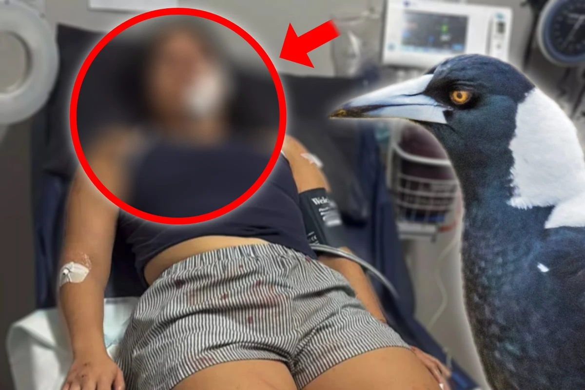 Vogel-Angriff endet im Krankenhaus: Frau schwer entstellt