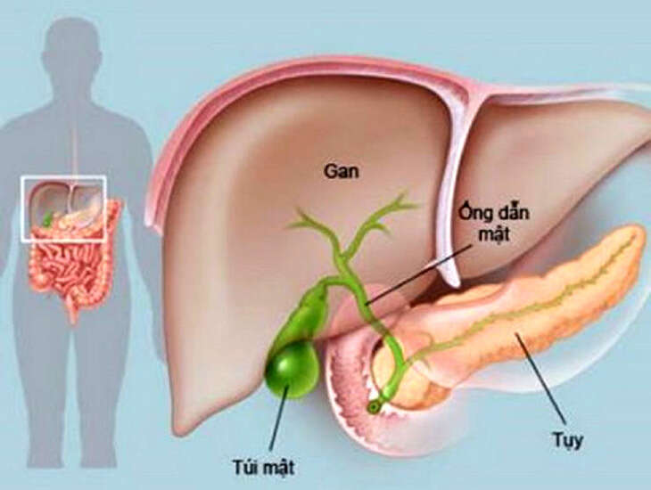 Viêm tụy cấp: máu đục như sữa