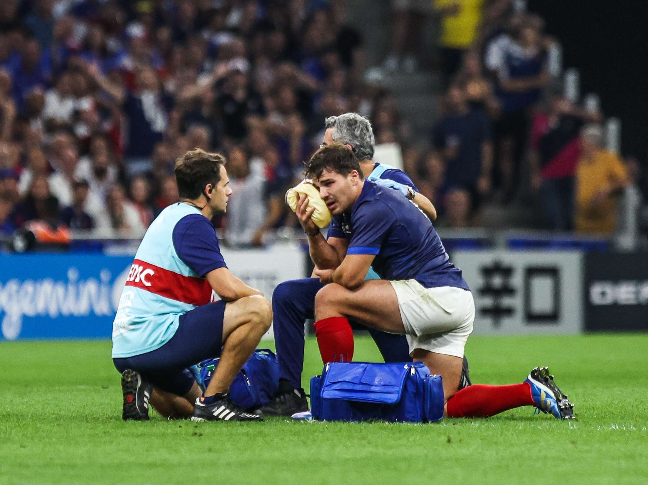 Rugby : près d’un an après sa fracture au visage, Antoine Dupont s’est enfin fait enlever les plaques