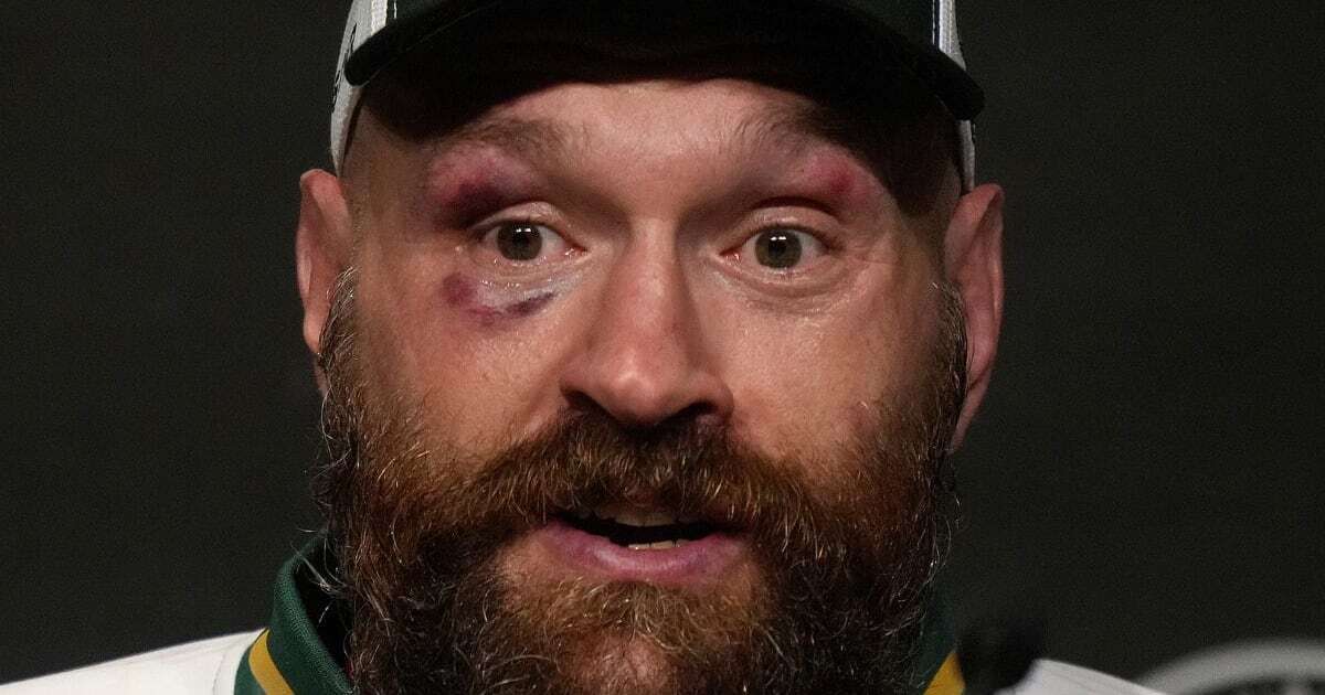 Tyson Fury anuncia su retiro del boxeo por quinta ocasión: ‘Nos vemos al otro lado’