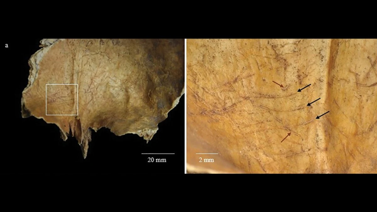 Brain removal likely used in Iron Age Scottish burial