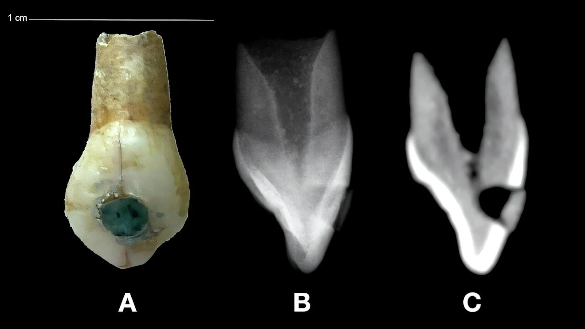 Jade gems decorated these Mayan kids’ teeth