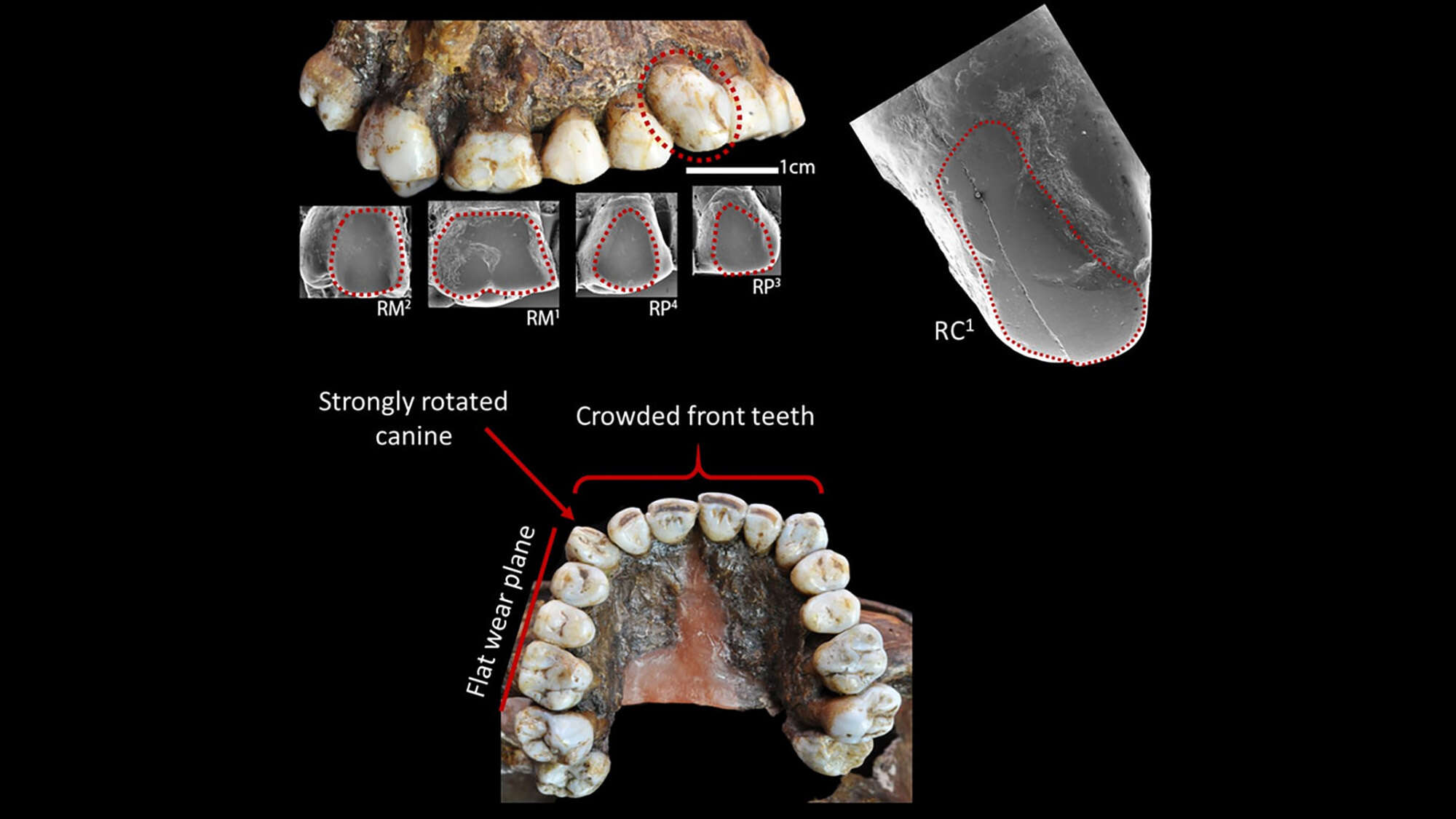 Ice Age hunter-gatherers may have had cheek piercings, even as children