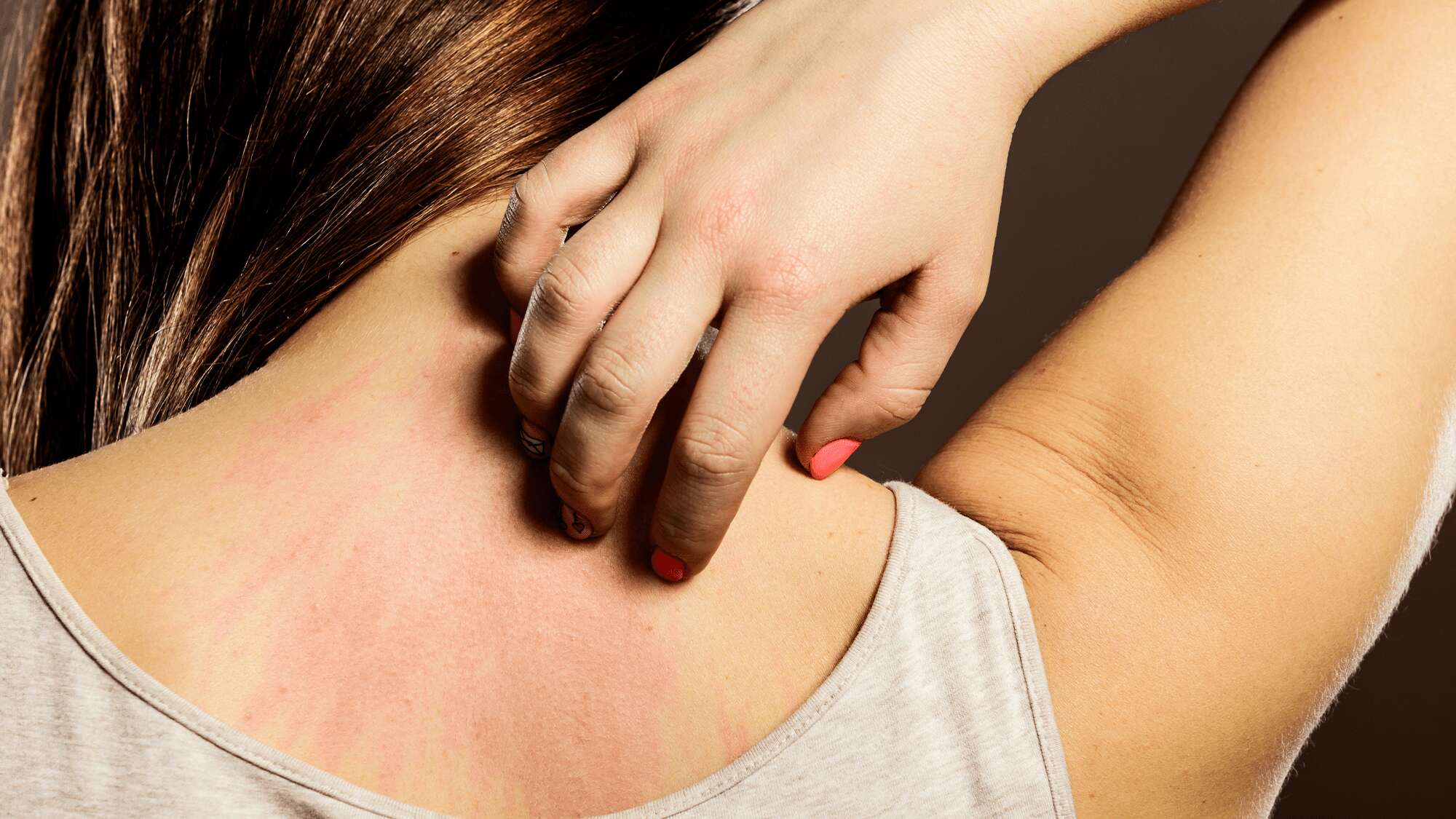 Why scratching a rash really does make it worse