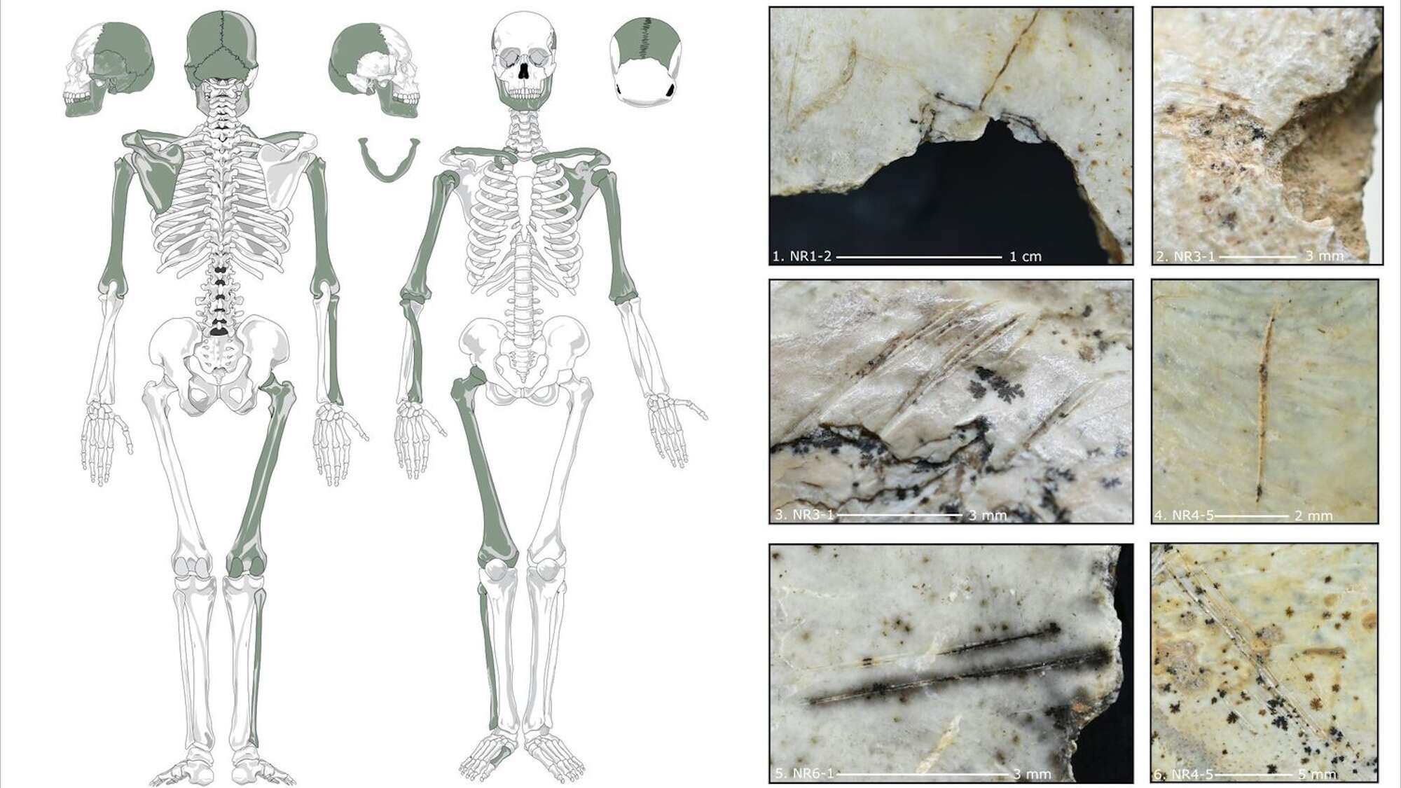 Butchered skulls point to Europe’s Ice Age cannibals