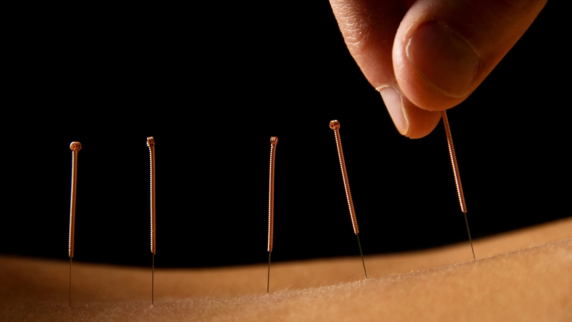 Oldest known steel acupuncture needles discovered in disgraced emperor’s tomb