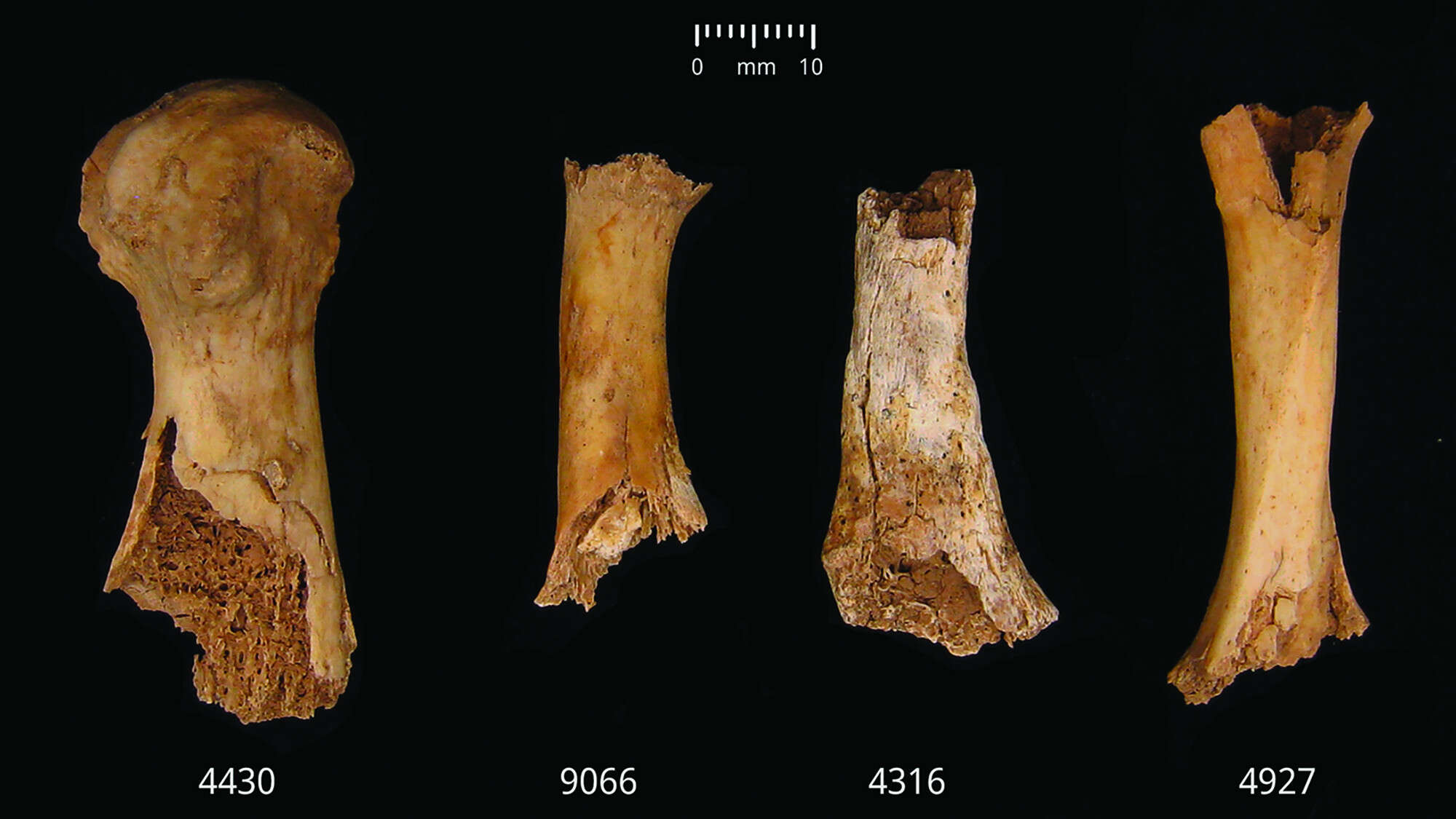 Bronze Age butchery and cannibalism unearthed in England