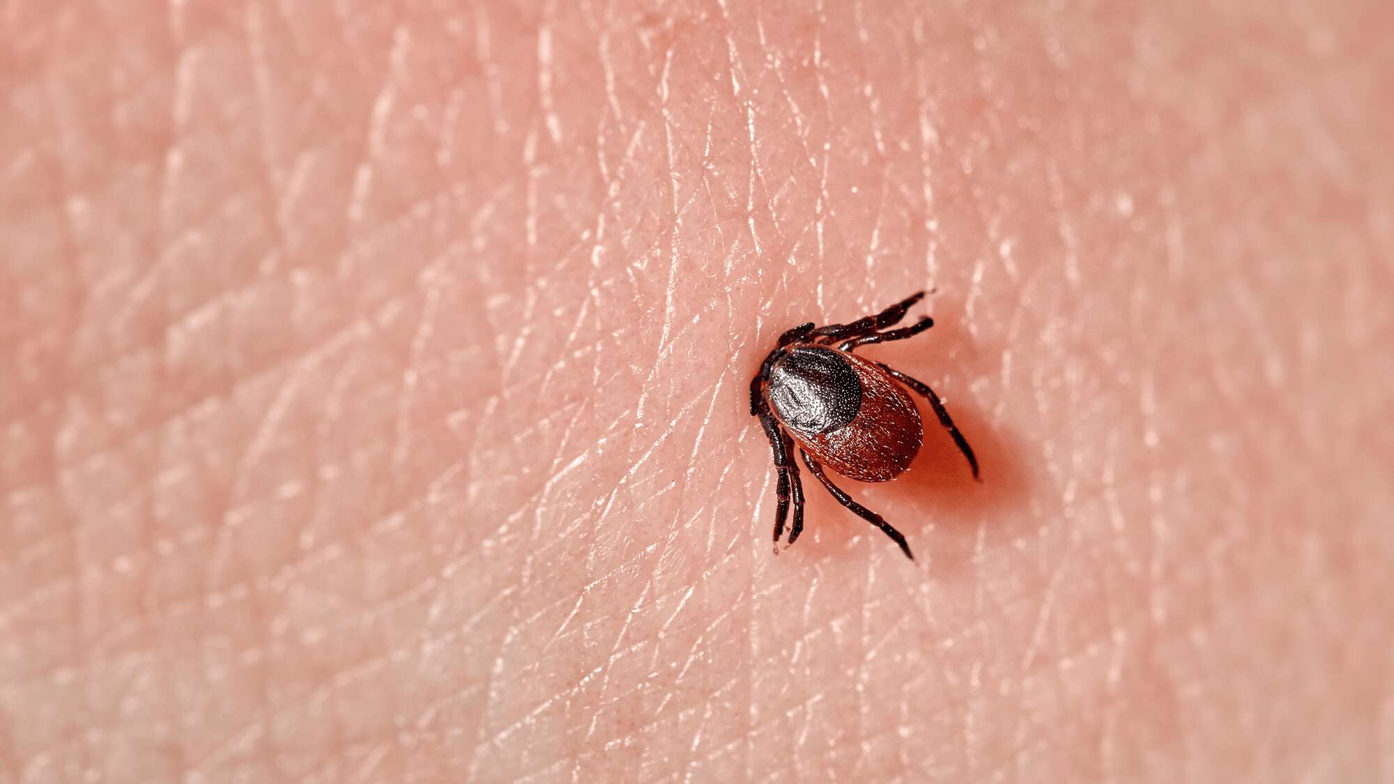 How hitchhiking ticks are bringing diseases to new places