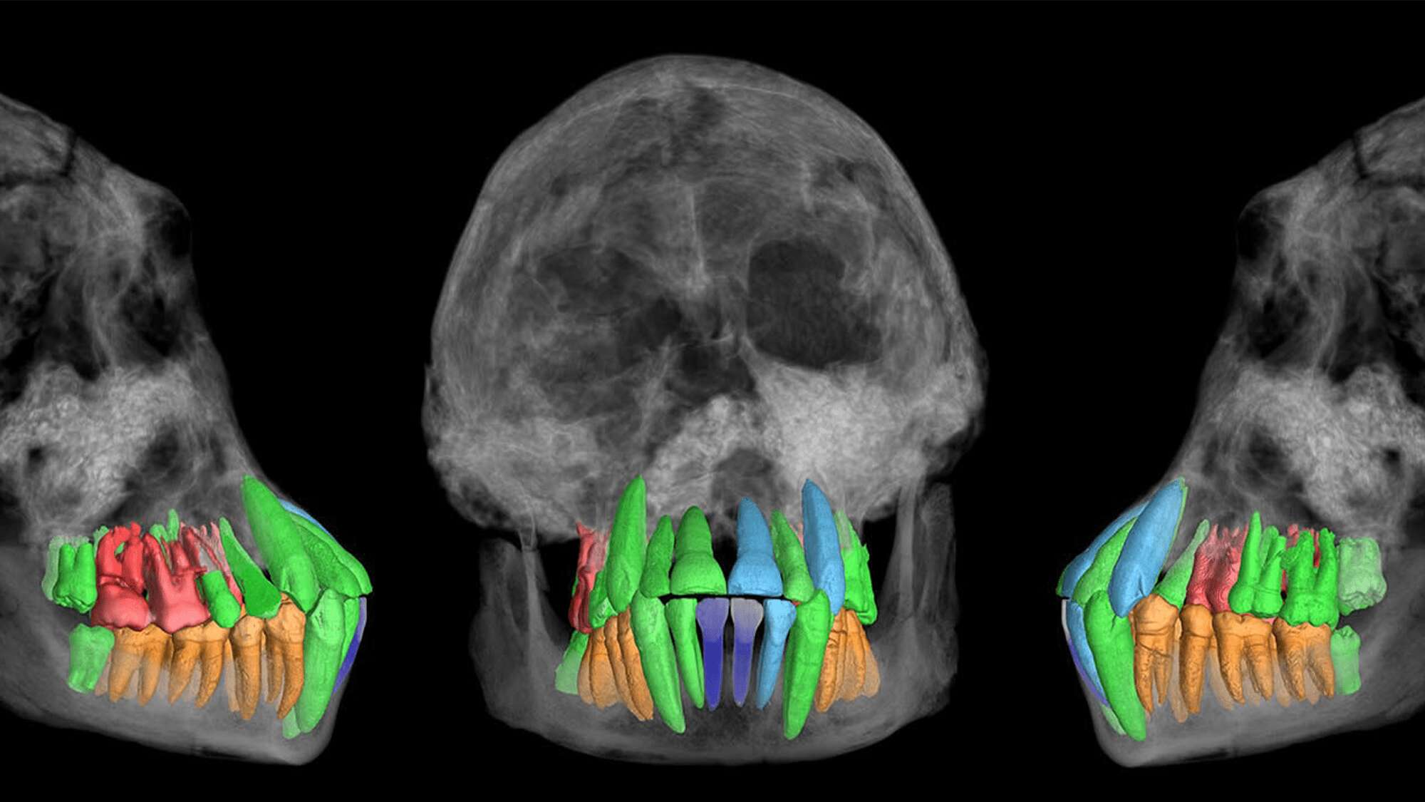 These 1.77-million-year-old teeth could help demystify human childhoods