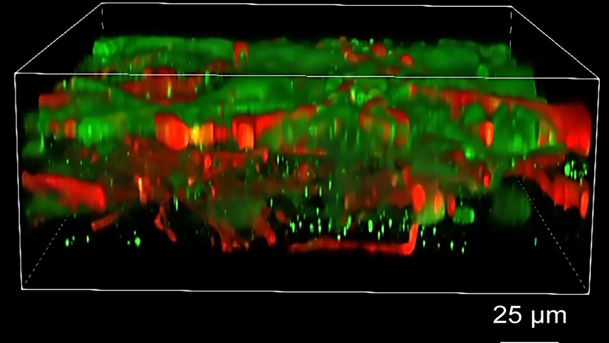 Scientists have 3D bioprinted functioning human brain tissue