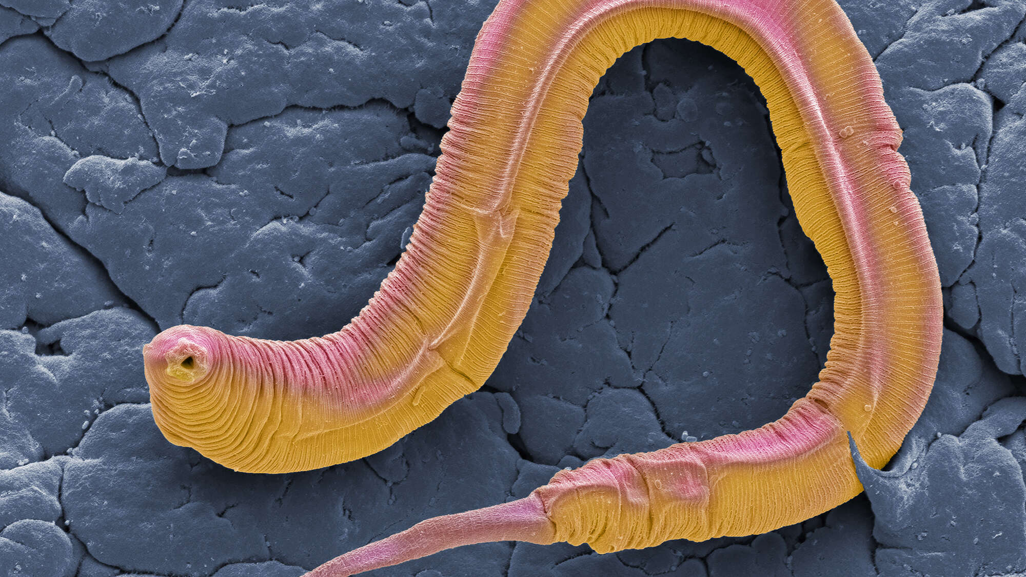 Why we die: Lessons on genes from a lowly worm