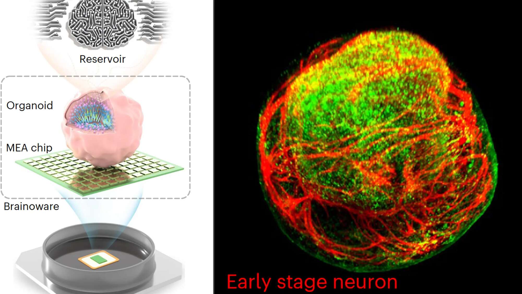 A ‘brain organoid’ biochip displayed serious voice recognition and math skills