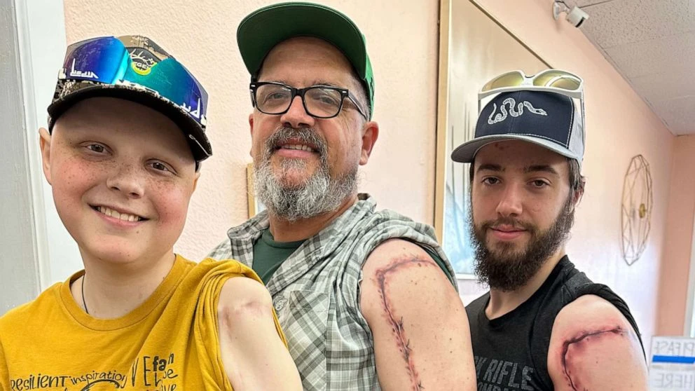 Family tattoo matches son's cancer surgery scar