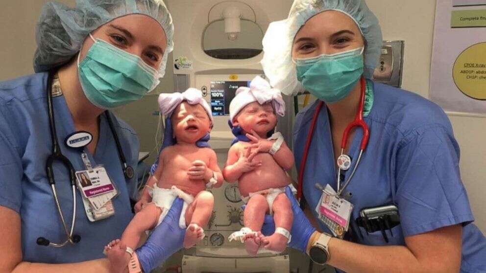 Twin babies share names with their nurses