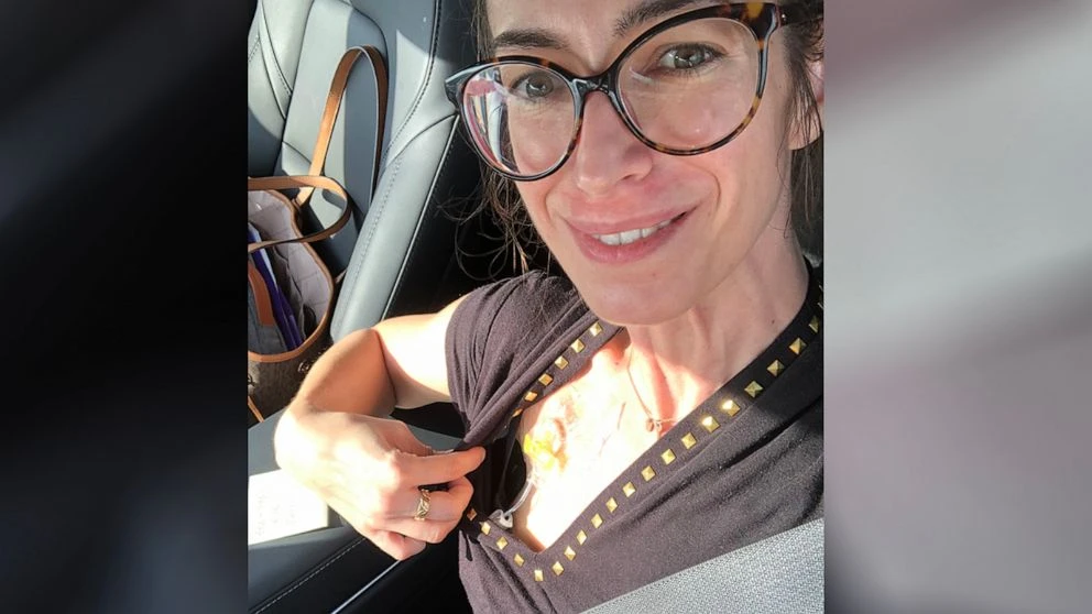 Young doctor who discovered her own cancer encourages others to get screenedDr. Lauren Juyia first learned she had cancer last year, when she was just 37.4/6/2023 05:29:31 EDT