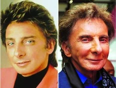 Barry Manilow reveals he's only ever had 1 facelift, slams Botox rumours