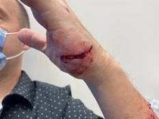 Air Canada pilot viciously attacked by dog in Etobicoke hotel parking lot