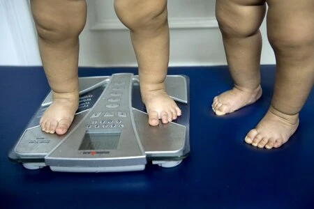Malbouffe : l’obésité, première forme de malnutrition chez les 5-19 ans dans le monde