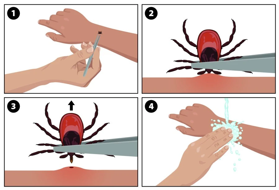 Experts advise caution with tick numbers high in Northeast
