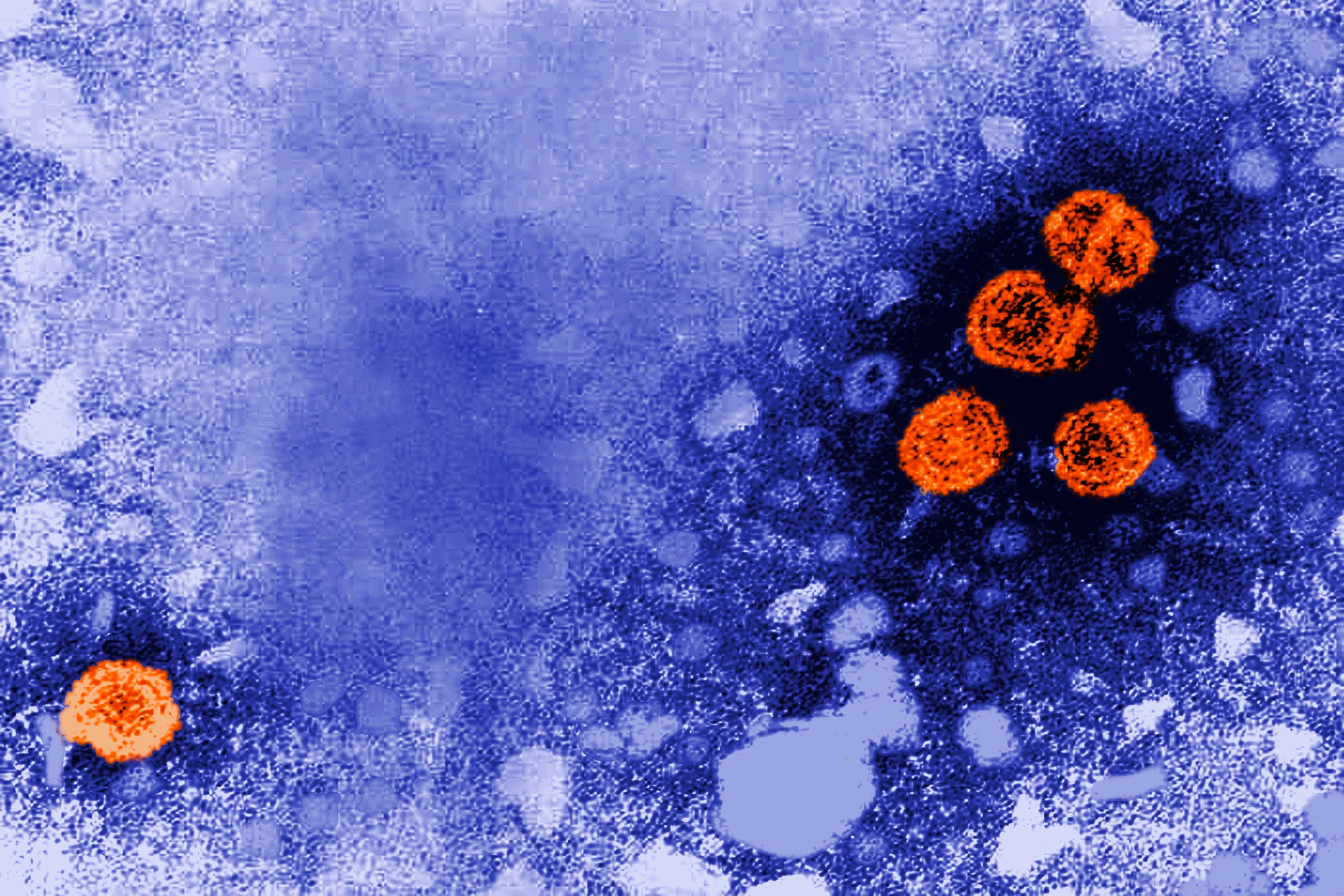 2 scientists charged with bringing deactivated mpox virus into U.S. and lying to authorities