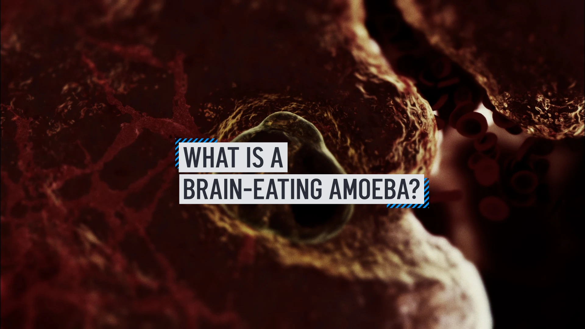 Texas woman dies from brain-eating amoeba after cleaning sinuses with tap water
