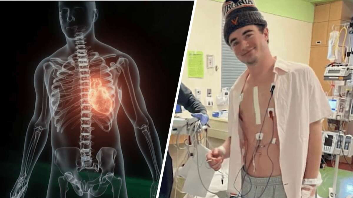 ‘Don't ignore it': Virginia college athlete sidelined by heart condition