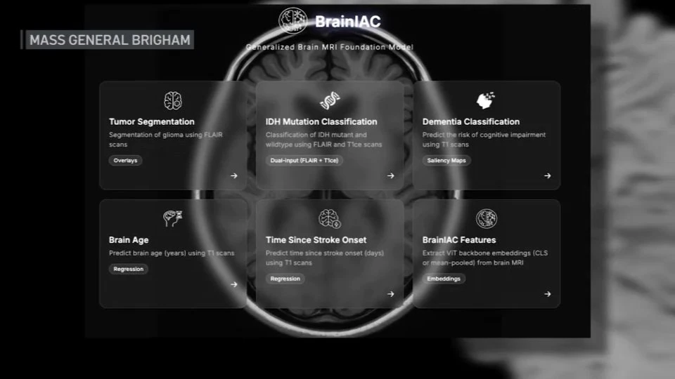How a doctor monitors herself for glioblastoma and the most common symptom