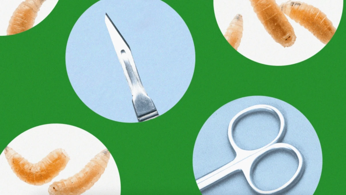 Got maggots? These doctors are bringing the bugs into their practice on purpose