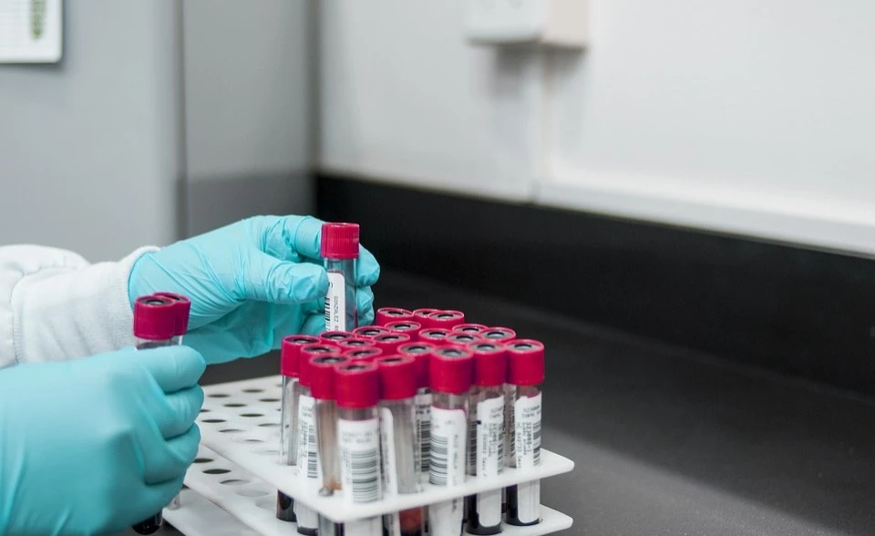 Could Lessons from the Covid-19 Response Boost HIV Research?