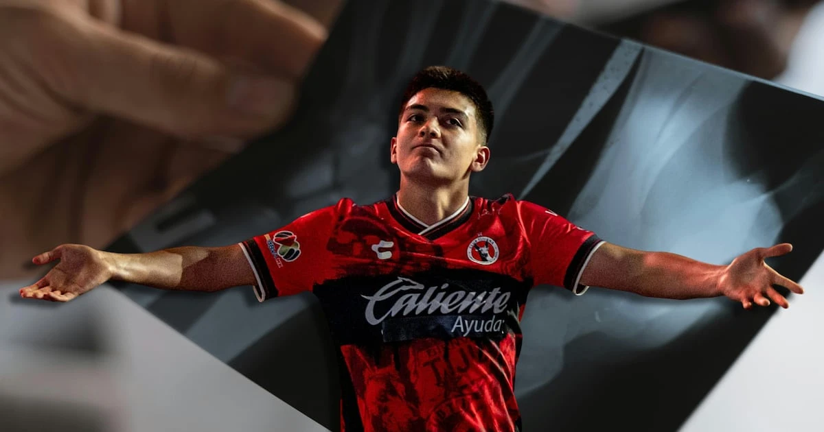 ¿Peligra Liguilla para Xolos? Gilberto Mora sufre fractura y fue operado de emergencia