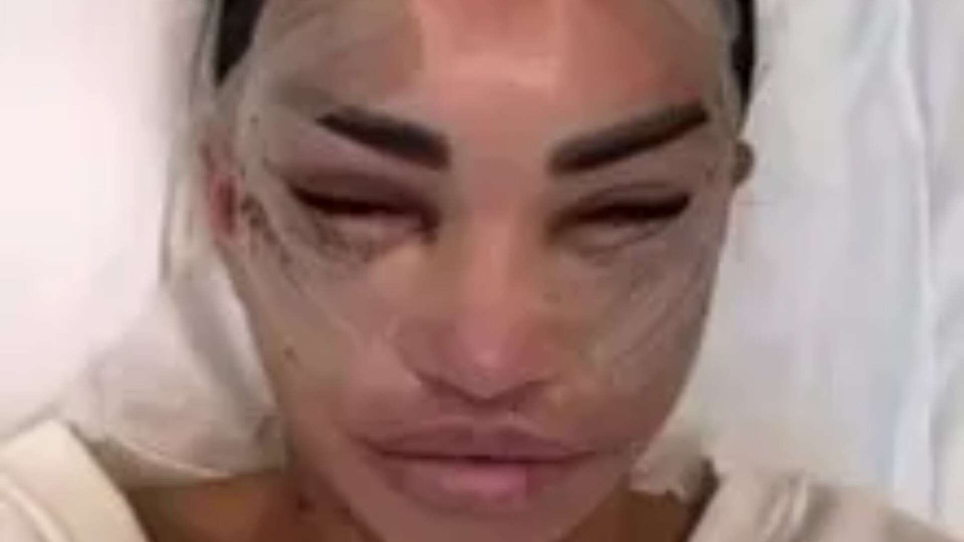 Katie Price shows off results of recent facelift surgery in bandages