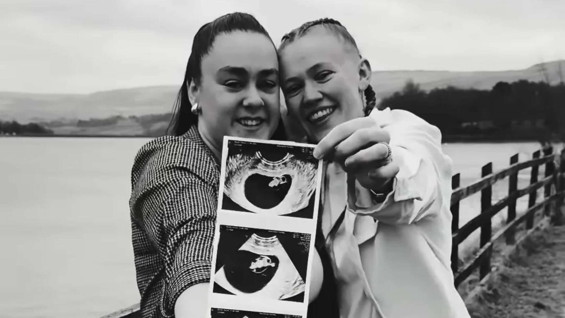 BGT golden buzzer star reveals she’s expecting first child with her fiancée