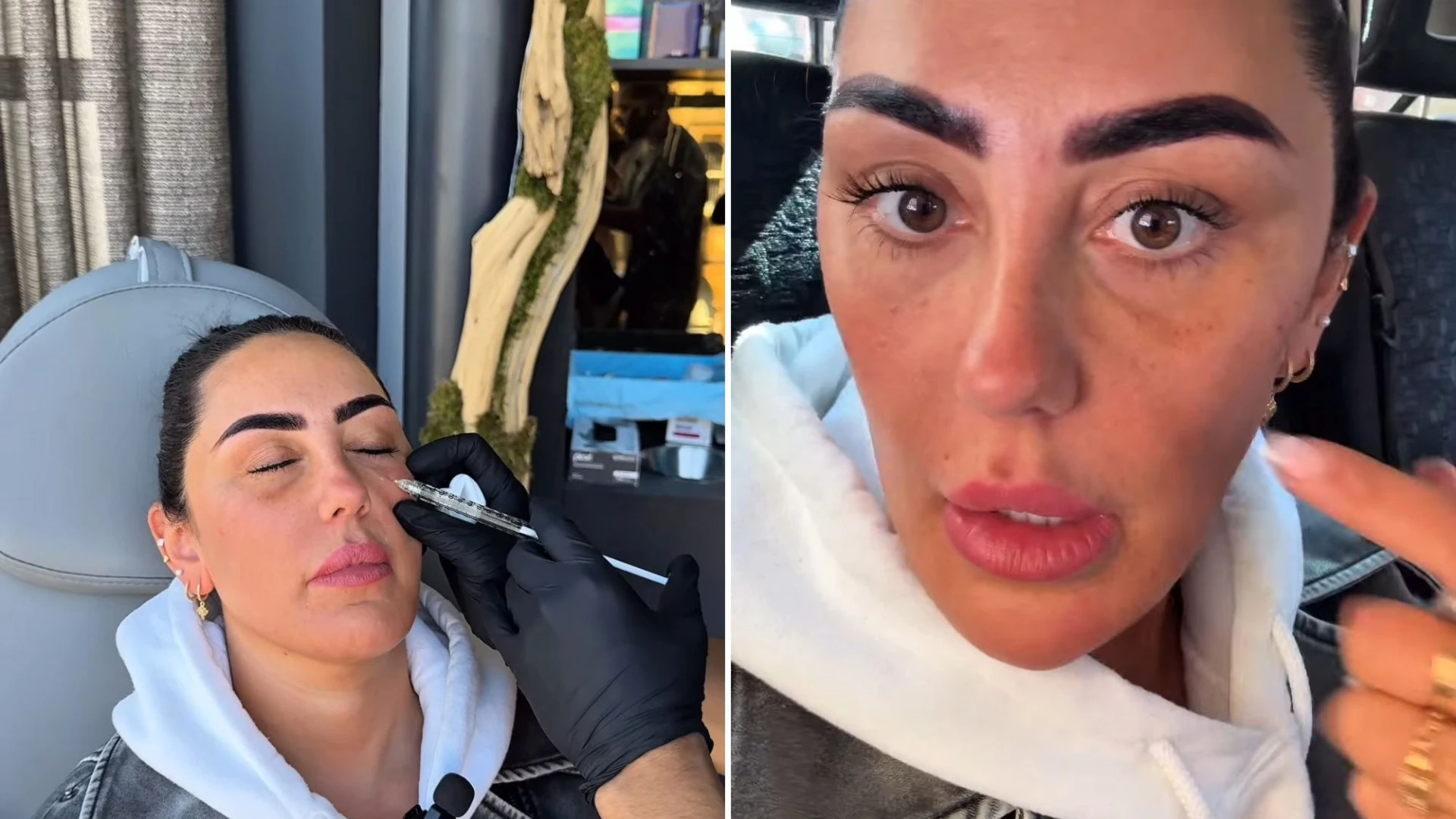 Geordie Shore's Sophie Kasaei reveals new face after her filler is dissolved