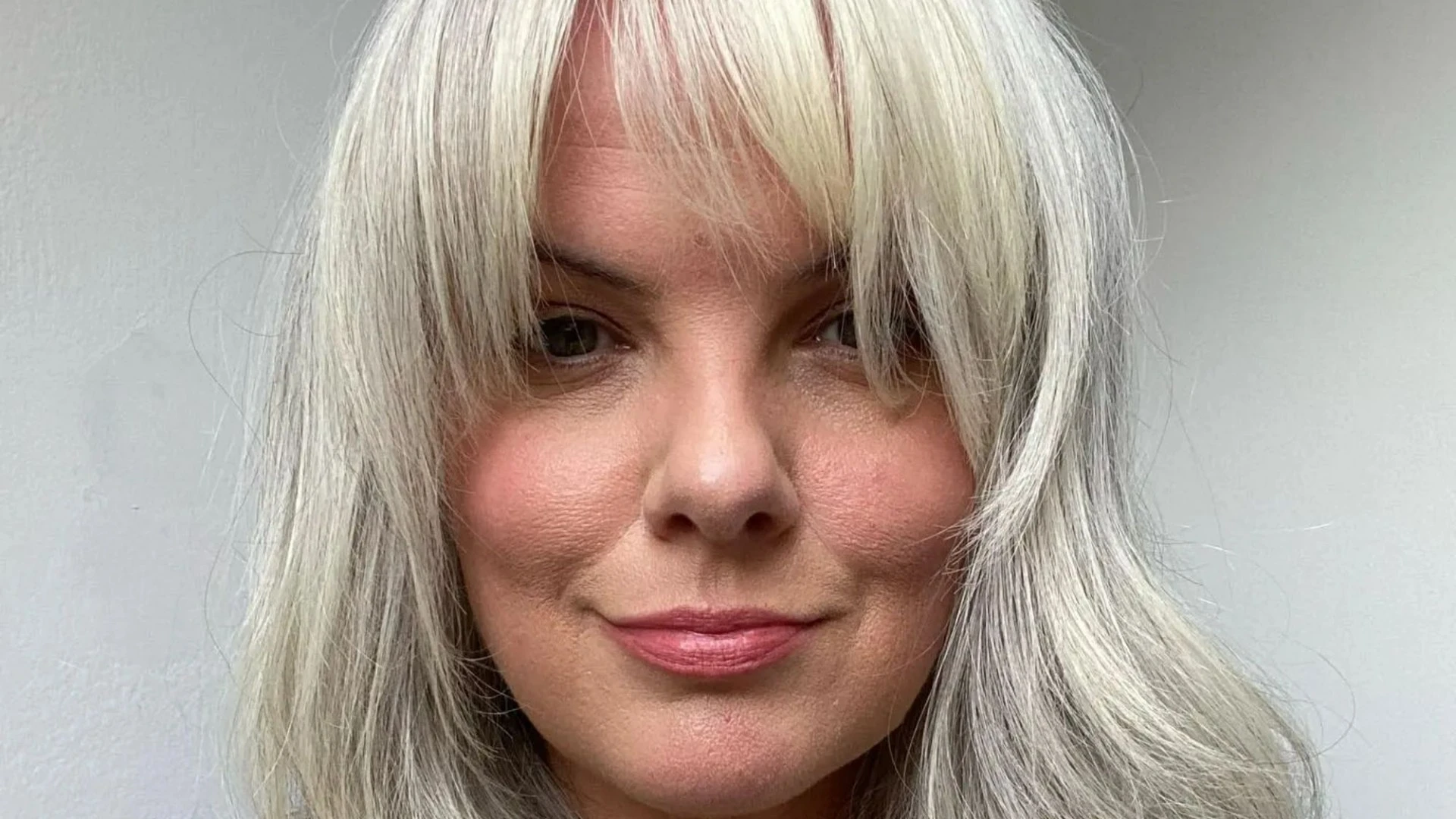 I used Botox for 15 years - but one photo put me off, I looked like a tambourine
