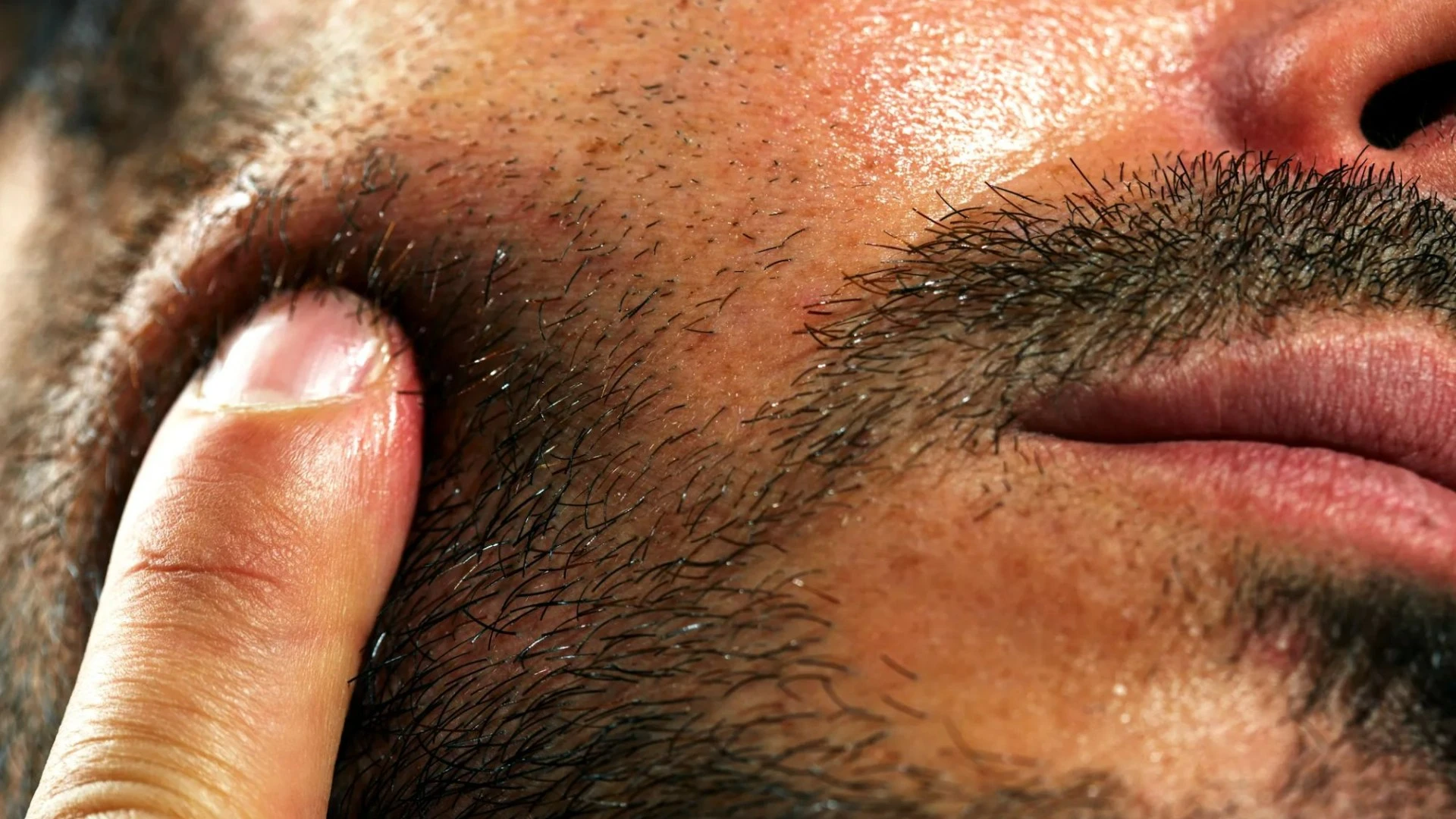 Man, 33, with ‘puffy face from hangover’ diagnosed with ‘swollen heart’