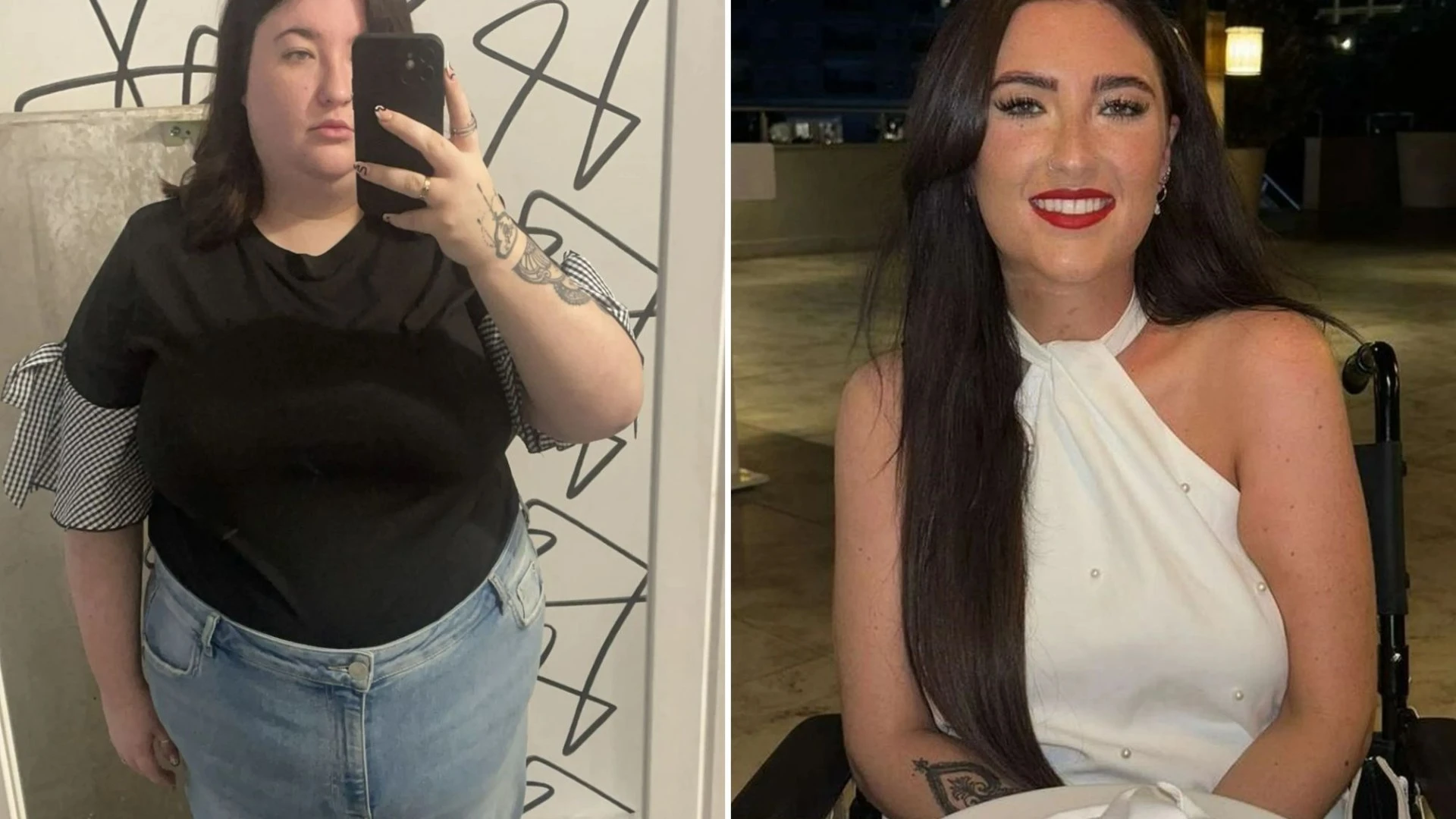 I lost 5 STONE in 12 weeks after £11k surgery but it almost killed me