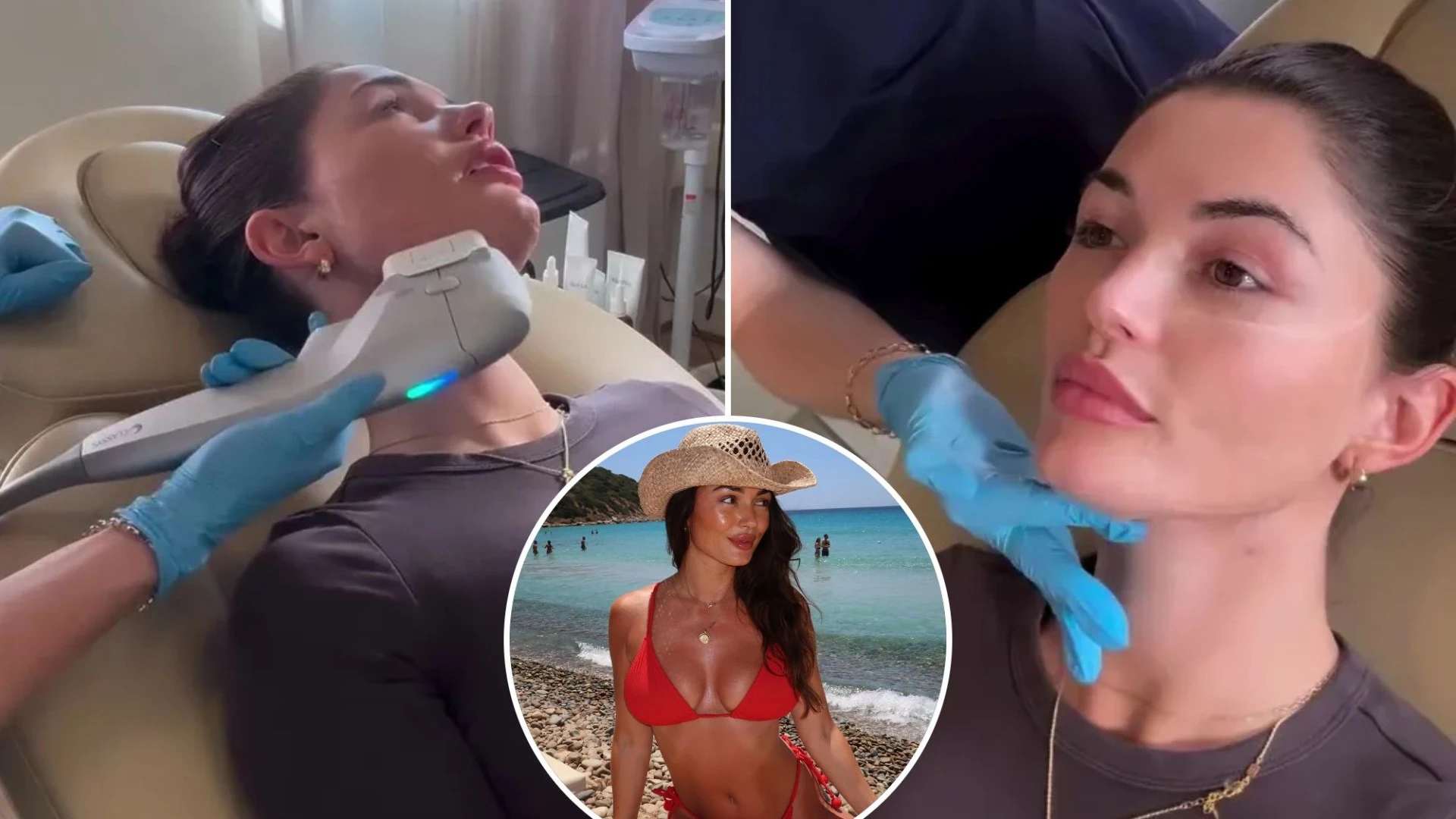 Love Island's India shows off 'new face' after getting 'fat pocket' removed