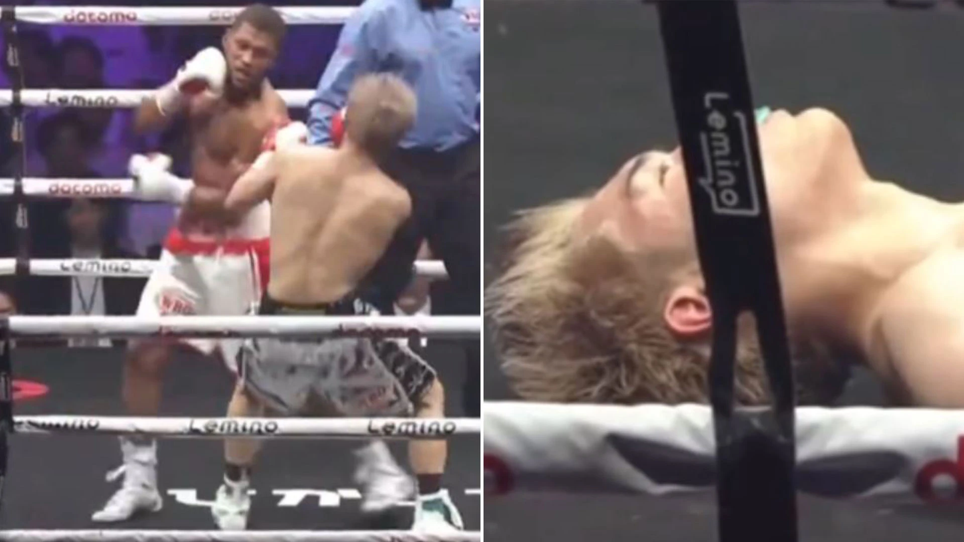 Boxer suffers six-week memory loss after KO and cannot remember fight