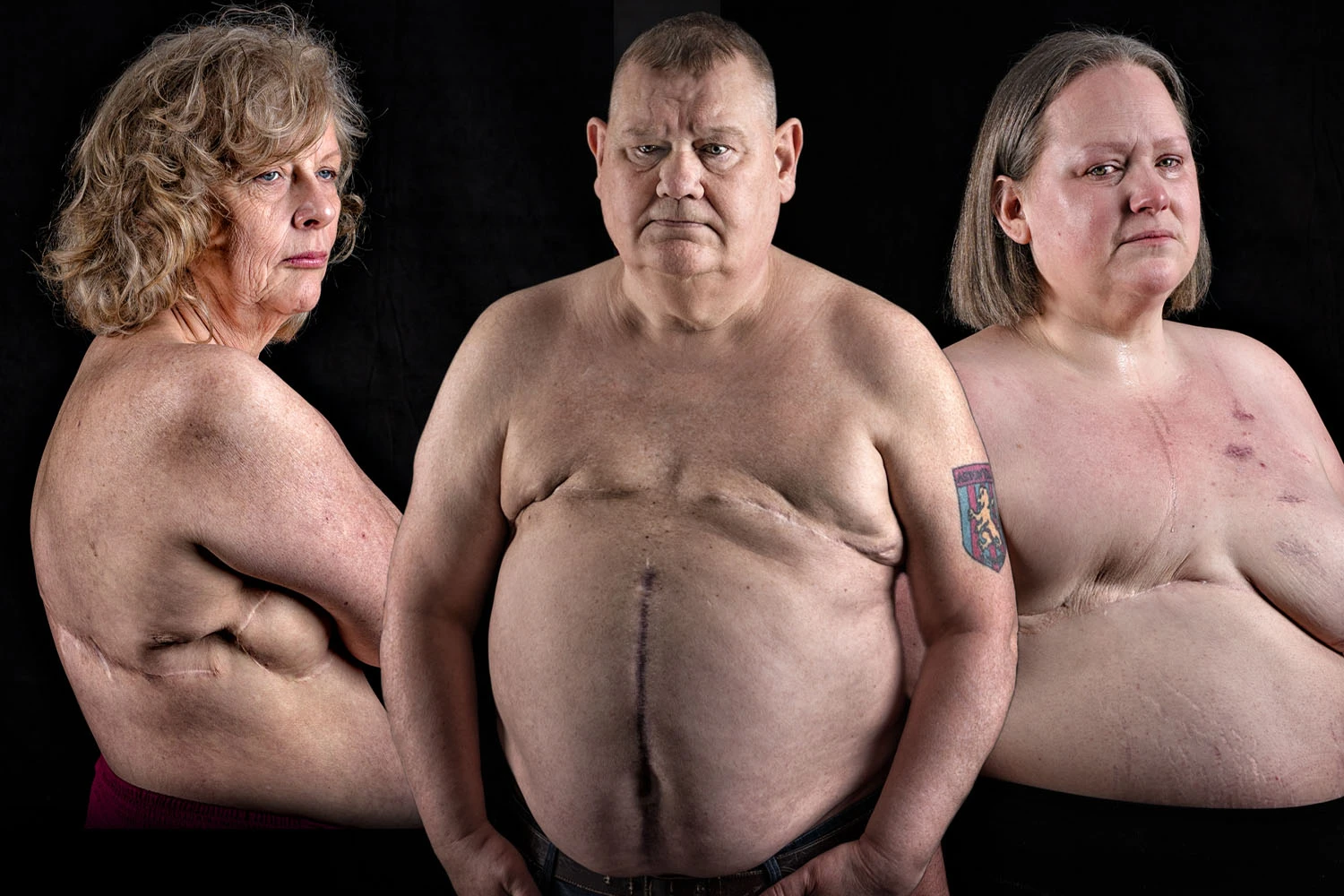 We have an incurable cancer half of Brits aren't aware of - know the 11 symptoms