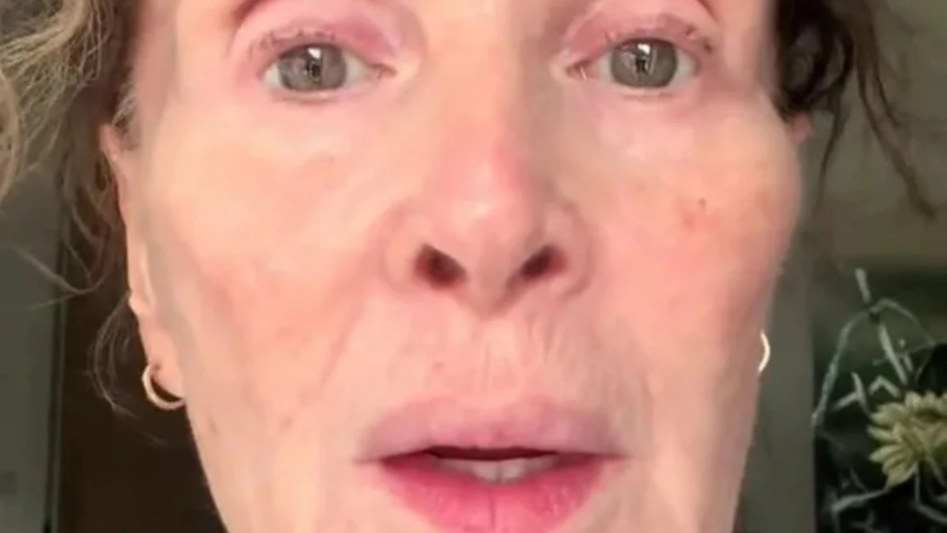 Coronation Street legend 'bares all' and reveals her face is 'collapsing'