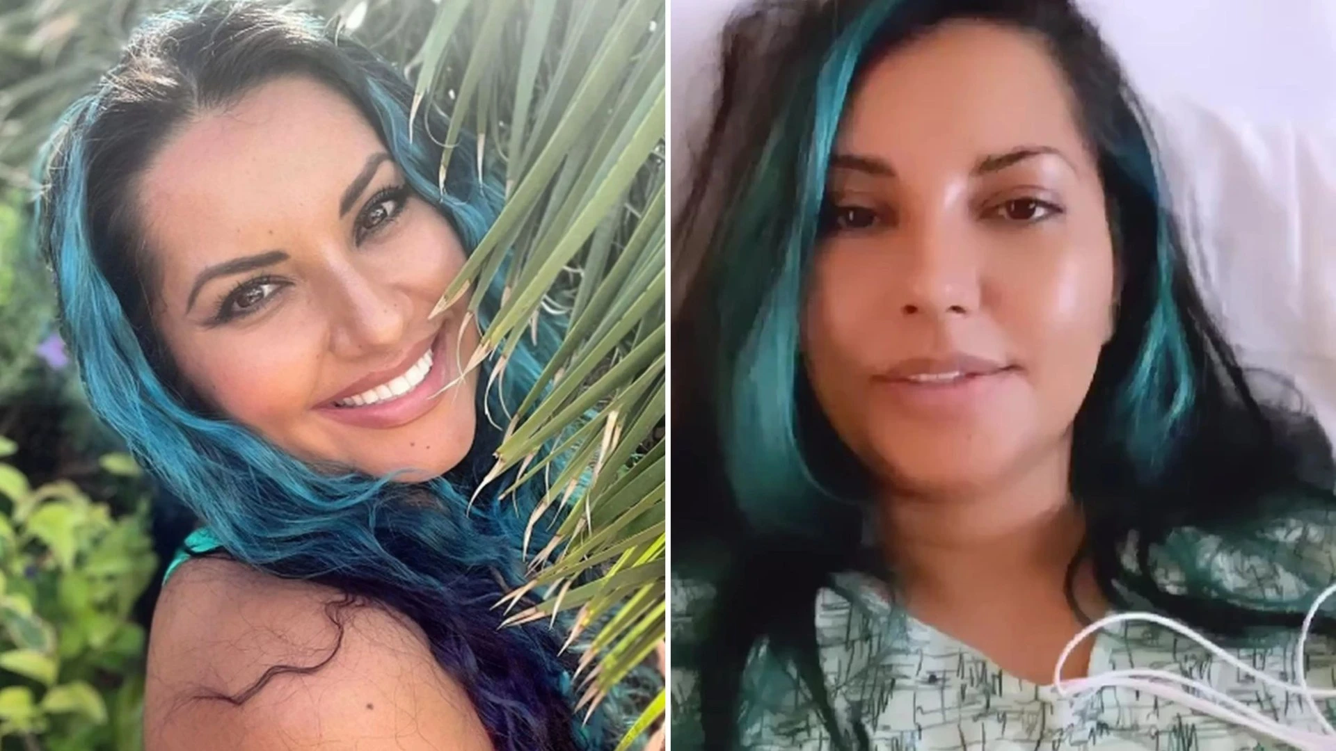I saw chiropractor for back pain - I blacked and was rushed to ICU with deadly tear