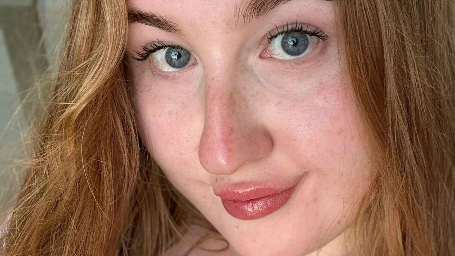 I had headaches my whole life - a change in symptoms signalled a brain tumour