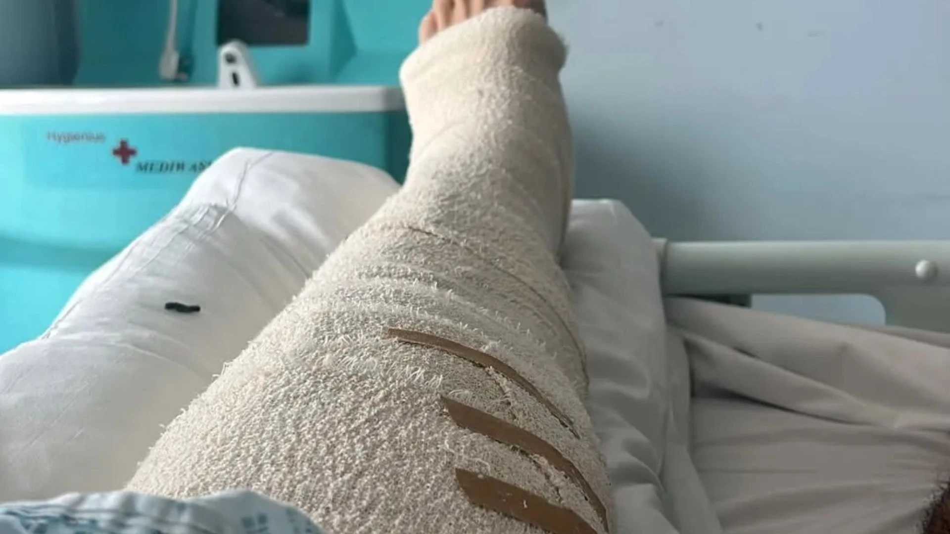 Netflix star left in agony with broken leg after terrifying bike accident