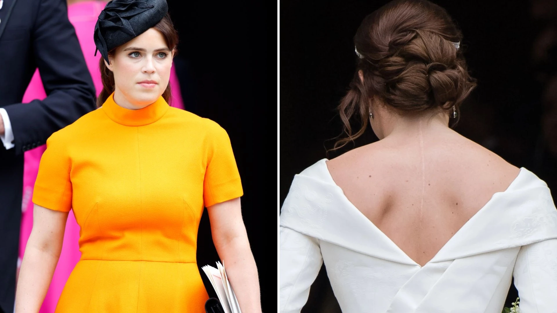 Princess Eugenie had to ‘train her brain’ to look at scoliosis scar as ‘cool’