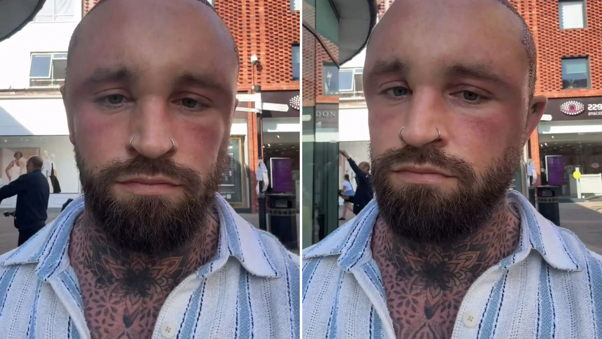 MAFS star sparks concern with extremely swollen head in pics after surgery