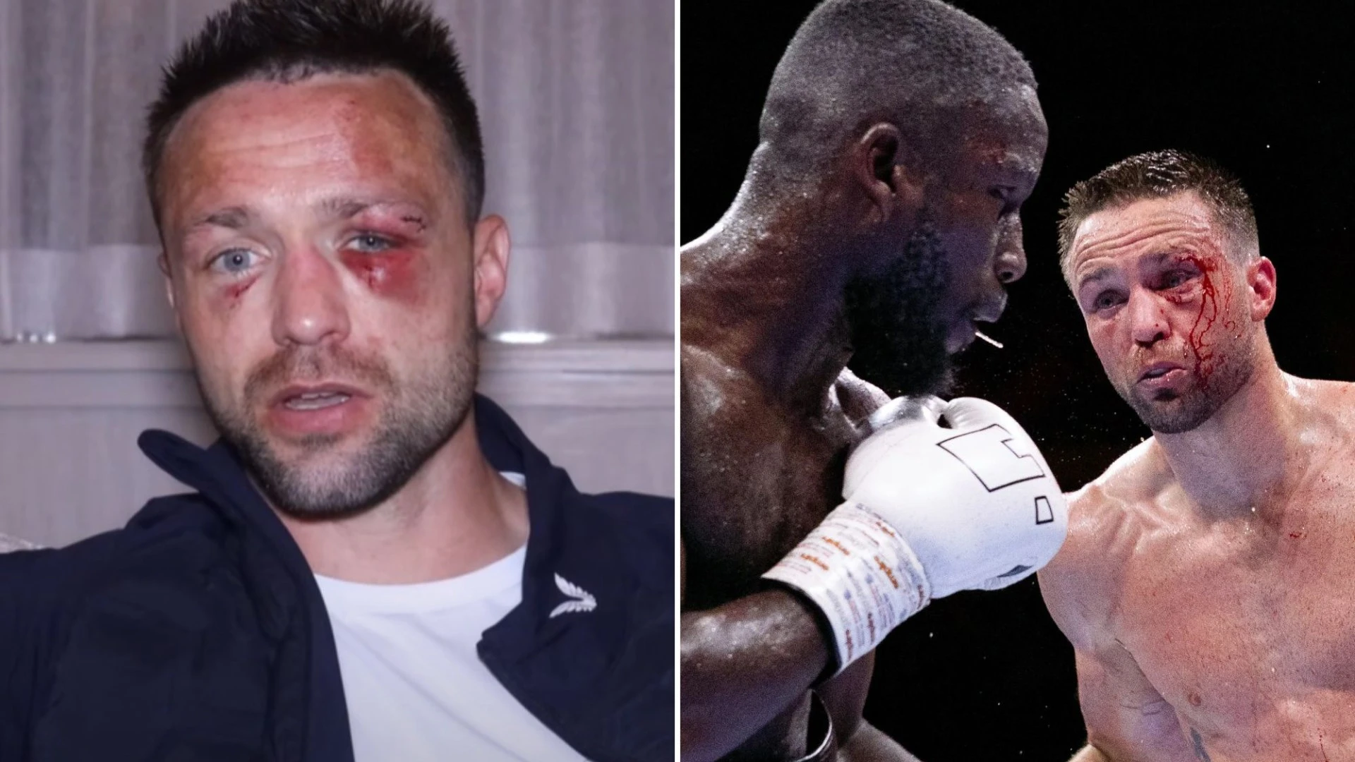 Taylor shows off brutal face injuries and explains why he stormed out of ring