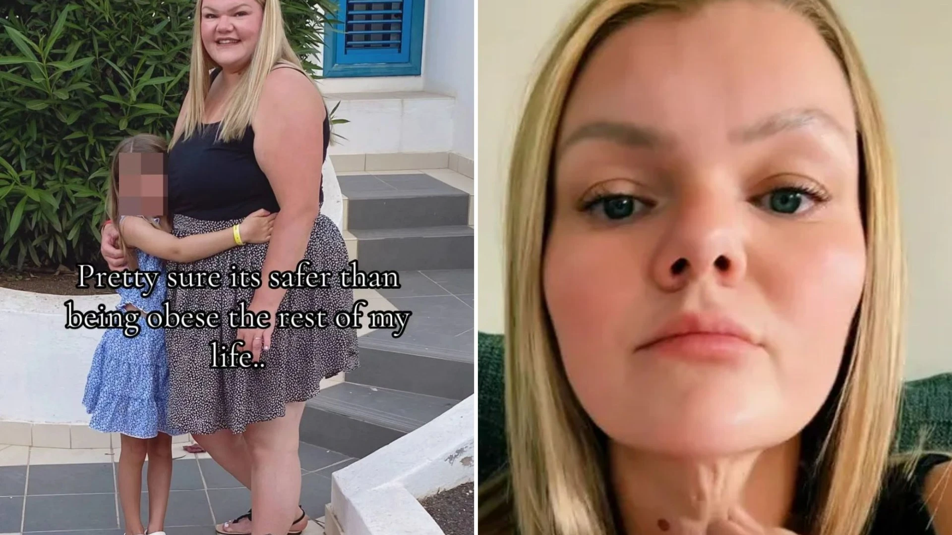 I've lost 5st on fat jabs... now my neck looks like that of a 51-year-old at 31