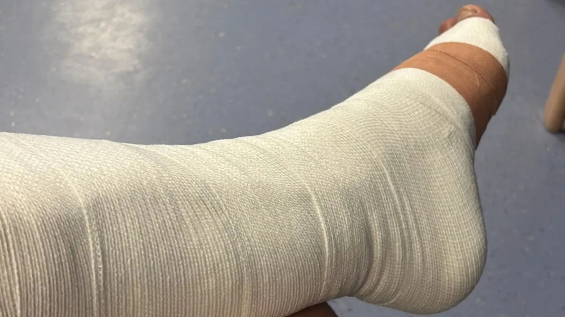 Boyband star shares hospital snap and reveals he will be on crutches for months